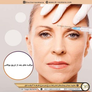 مراقبت های بعد از تزریق بوتاکس