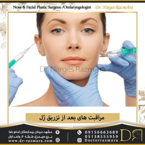 مراقبت های بعد از تزریق ژل