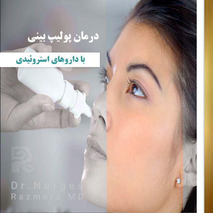 درمان-پولیپ-بینی-با-داروهای-استروئیدی