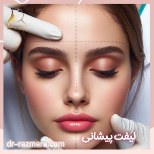 جراحی لیفت پیشانی در مشهد + دکتر نرگس رزم آرا