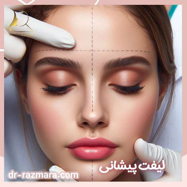 جراحی لیفت پیشانی در مشهد + دکتر نرگس رزم آرا