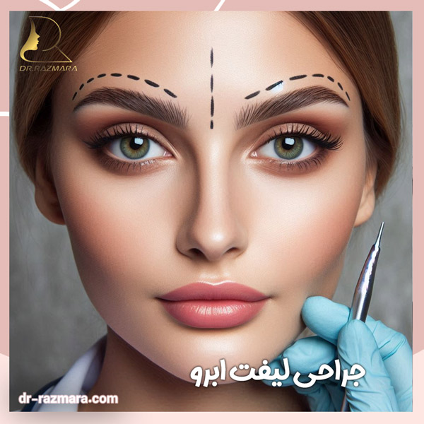 جراحی لیفت ابرو در مشهد + دکتر نرگس رزم آرا