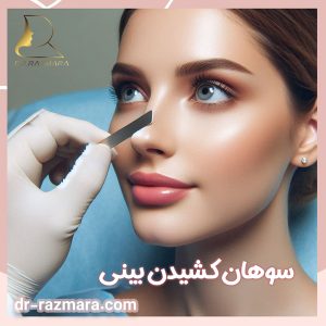 سوهان کشیدن بینی  + دکتر نرگس رزم آرا