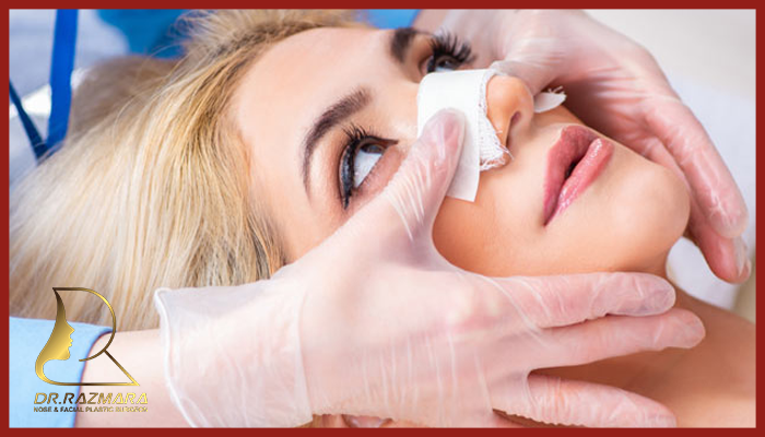 نکات مهم و ضروری بعد از جراحی بینی 