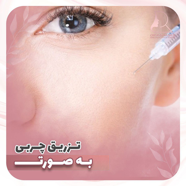 تزریق چربی به صورت در مشهد - دکتر رزم آرا