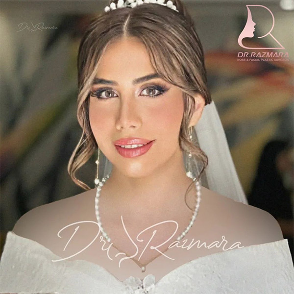 جراحی بینی در مشهد - دکتر رزم آرا