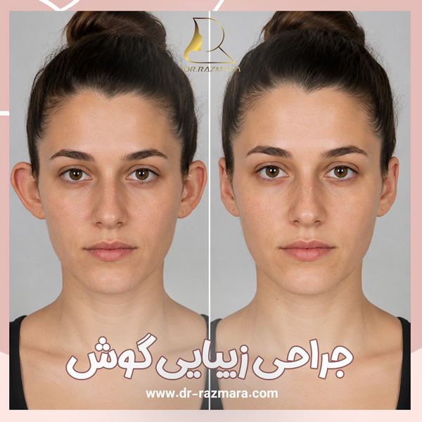 جراحی زیبایی گوش در مشهد + دکتر نرگس رزم آرا