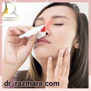 خونریزی بعد از عمل بینی - دکتر رزم آرا