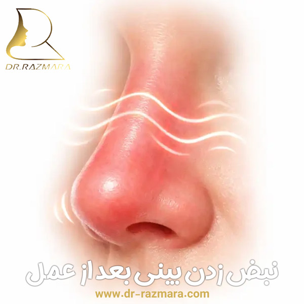 نبض زدن بینی بعد از عمل + دکتر نرگس رزم آرا