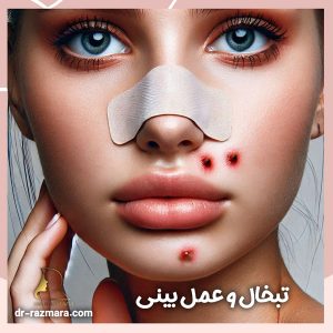تبخال و عمل بینی + دکتر نرگس رزم آرا