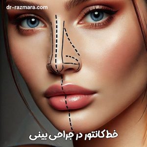 خط کانتور در جراحی بینی + دکتر نرگس رزم آرا