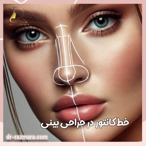 خط کانتور در جراحی بینی + دکتر نرگس رزم آرا