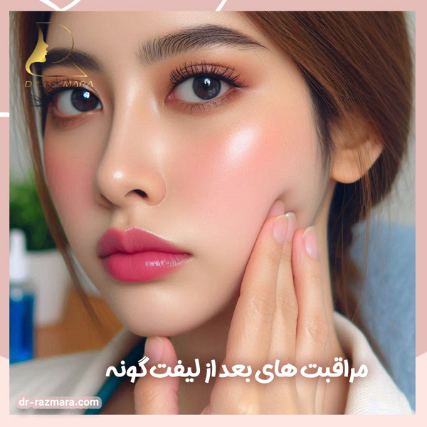 مراقبت‌ های بعد از لیفت گونه + دکتر نرگس رزم آرا