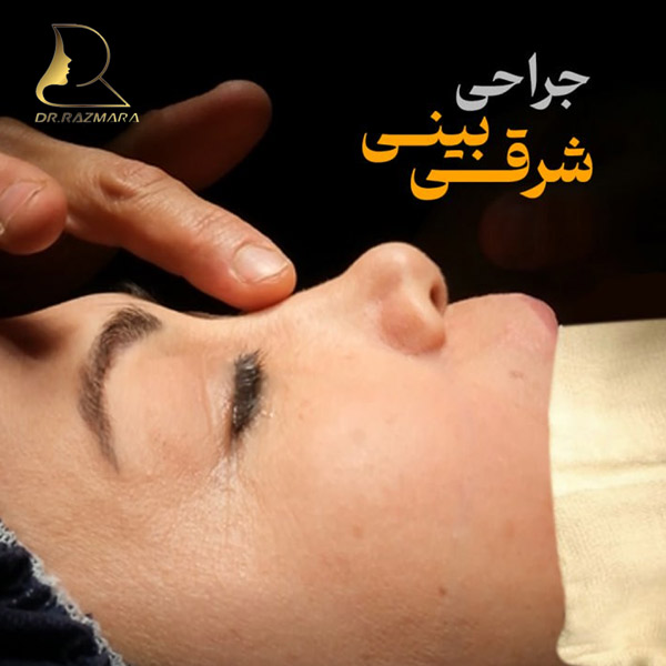 عمل بینی شرقی در مشهد + دکتر نرگس رزم آرا
