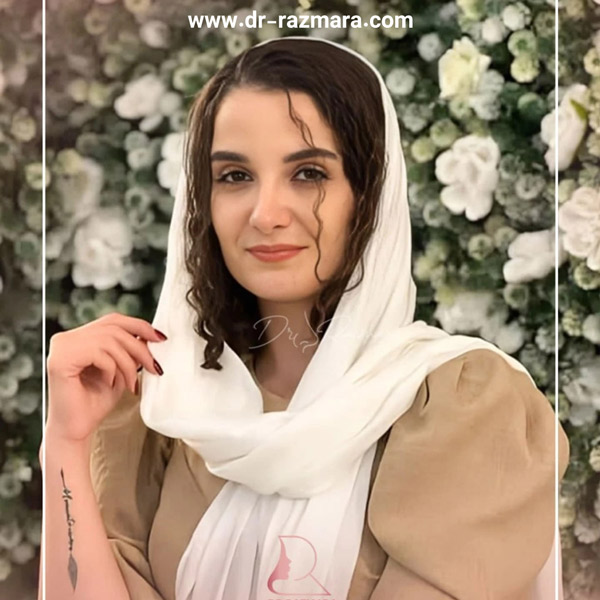 جراحی بینی نیمه فانتزی + دکتر نرگس رزم آرا