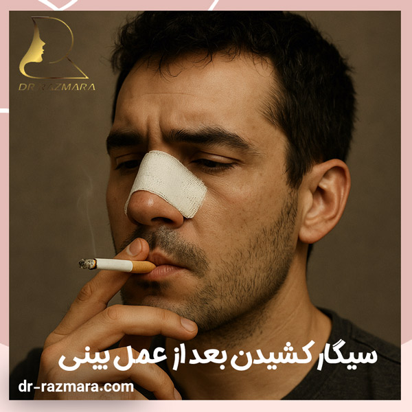 ترک سیگار کشیدن بعد از عمل بینی + دکتر رزم آرا