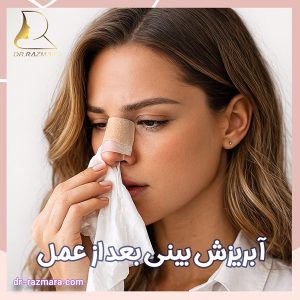 آبریزش بینی بعد از عمل + دکتر نرگس رزم آرا