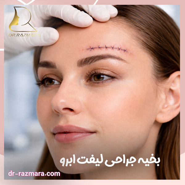 بخیه جراحی لیفت ابرو | دکتر نرگس رزم آرا
