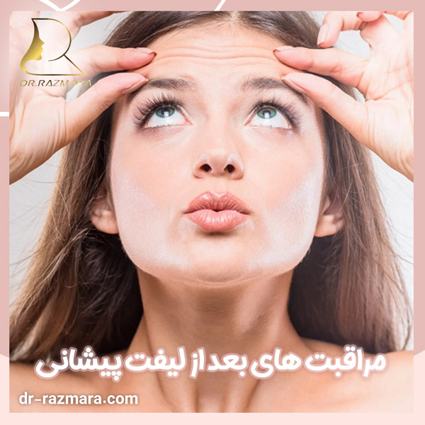 مراقبت های بعد از لیفت پیشانی + دکتر نرگس رزم آرا