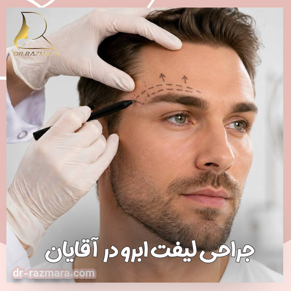 جراحی لیفت ابرو در آقایان + دکتر نرگس رزم آرا