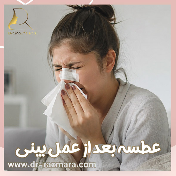 عطسه بعد از عمل بینی + دکتر نرگس رزم آرا