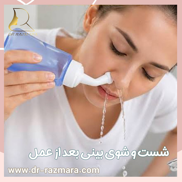 شست و شو بینی بعد از عمل + دکتر نرگس رزم آرا
